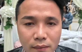 男士做半永久线条眉后眉毛图片