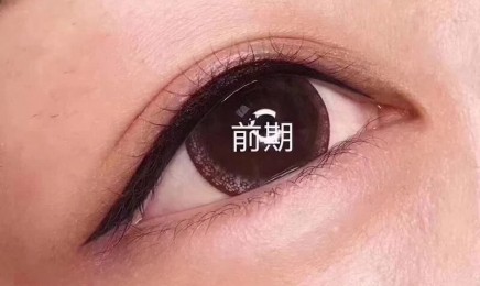 半永久纹美瞳线前后期对比照片